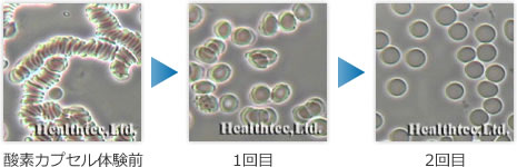 体験前と体験後の赤血球の様子
